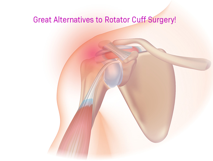 illustration of what makes up a rotator cuff
